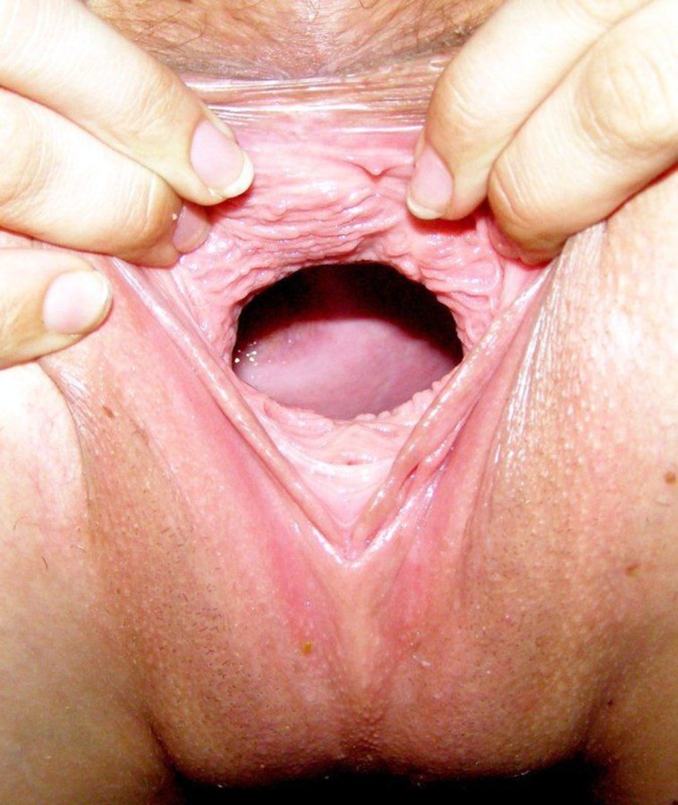 Анальный расширитель anal speculum